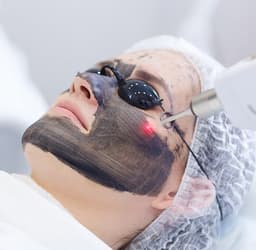 LASER TONING AND CARBON PEEL LASER